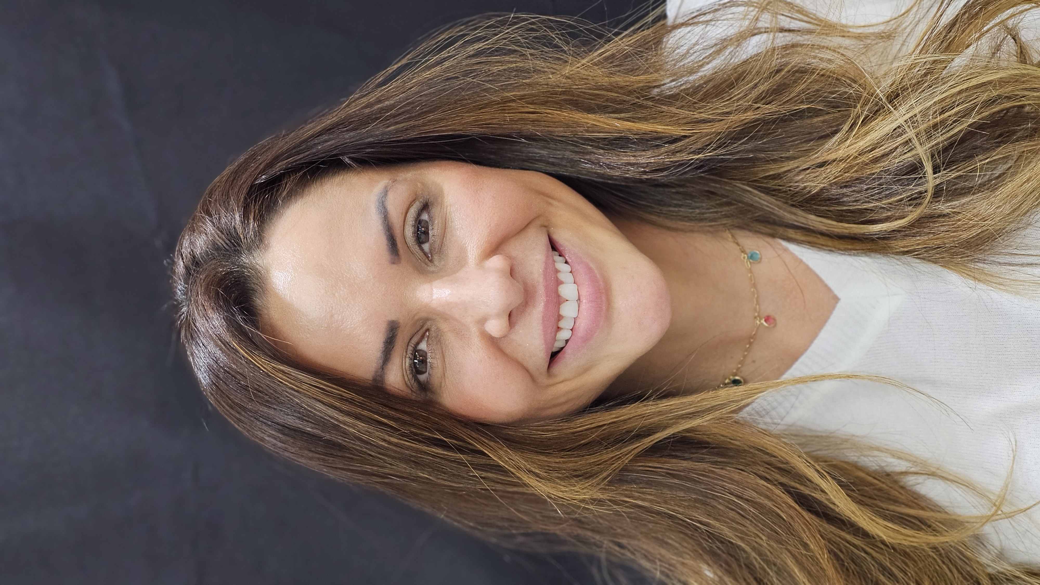 Aumento de coroa Depois